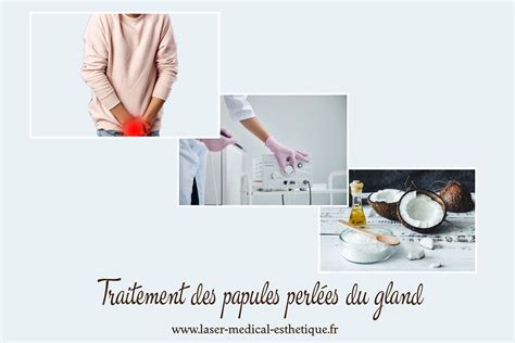 couronne perle du gland|LES PAPULES PERLEES DU GLAND